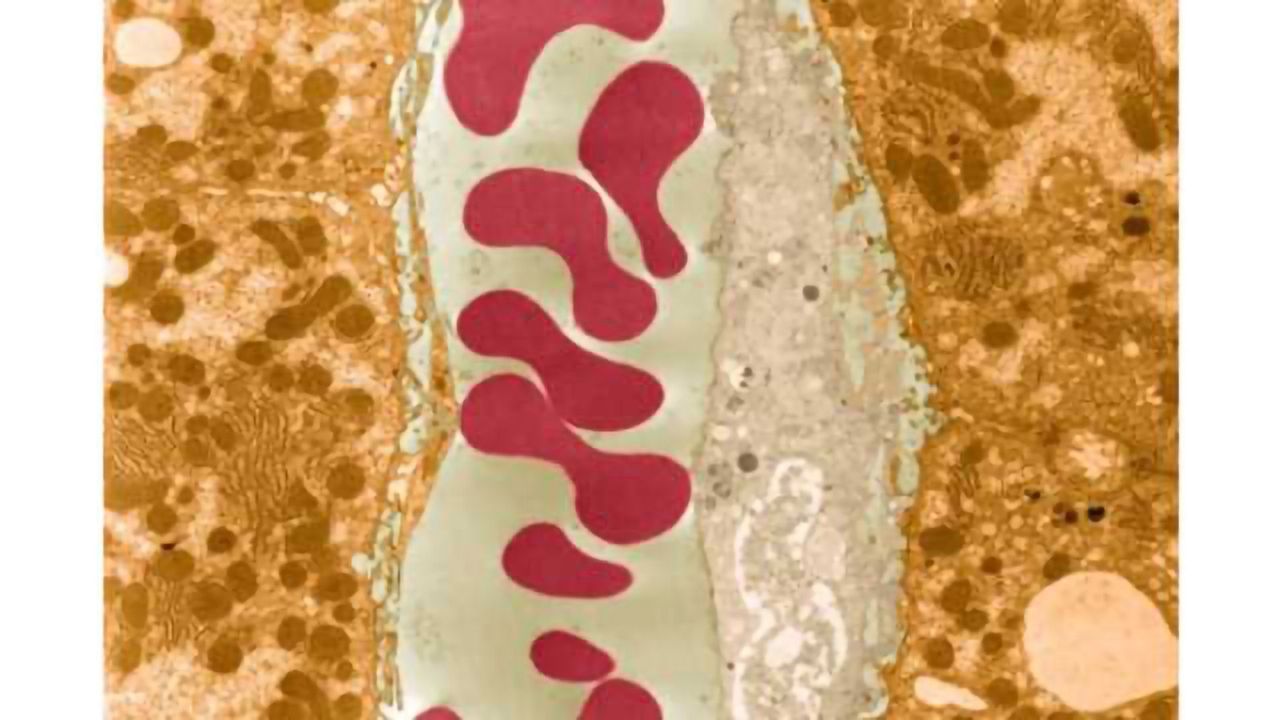 Changes in a blood-based molecular pathway identified in Alzheimer’s disease
