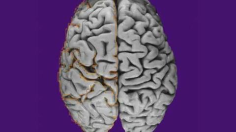 Mutations taking place only in the brain identified as the cause of intractable epilepsy