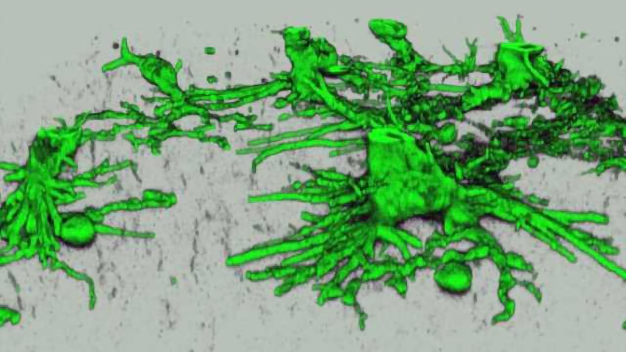 Research into brain’s ability to heal itself offers hope for novel treatment of traumatic brain injury