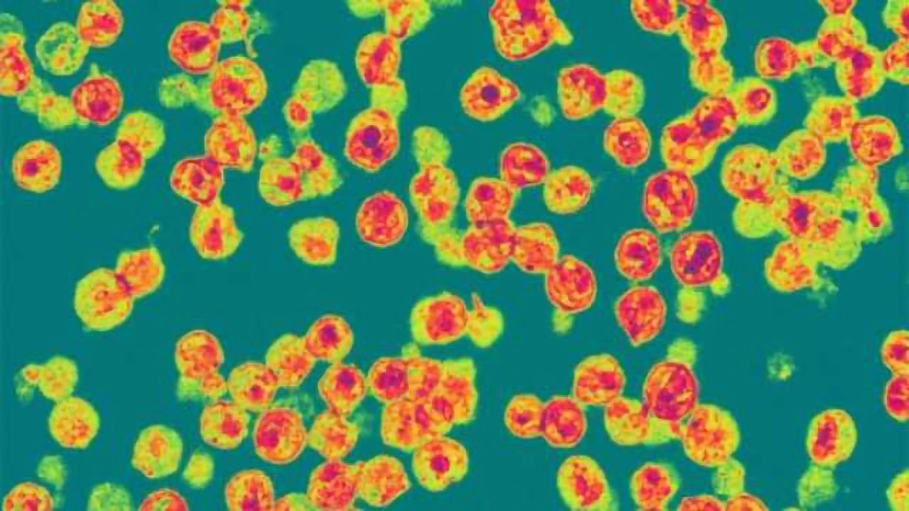 Timeline for HIV replication in the brain identified