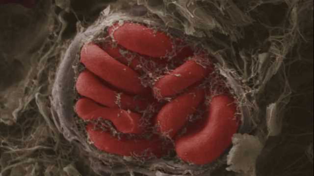 Promising new biomarkers for concussion found
