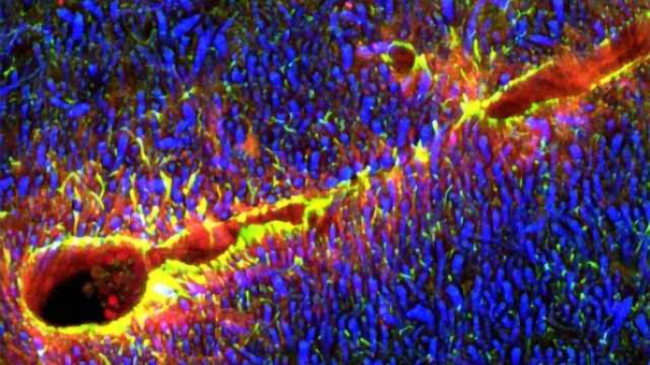 Nanorobotic agents open the blood-brain barrier, offering hope for new brain treatments