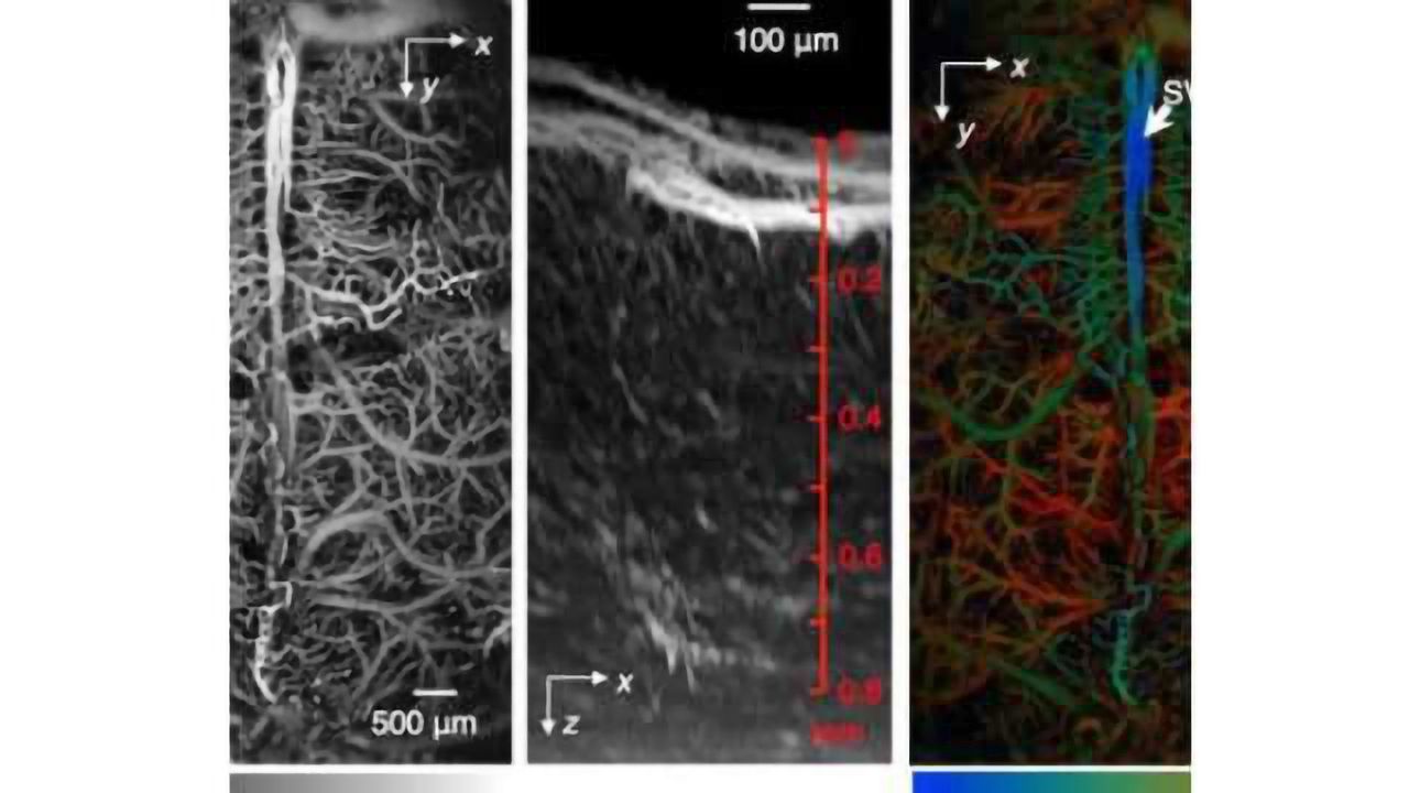 High-tech method allows rapid imaging of functions in living brain