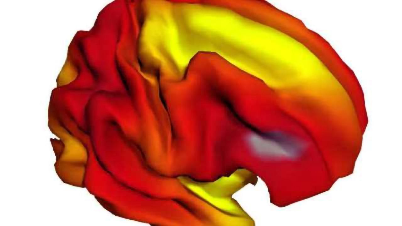 Family income, parental education related to brain structure in children and adolescents