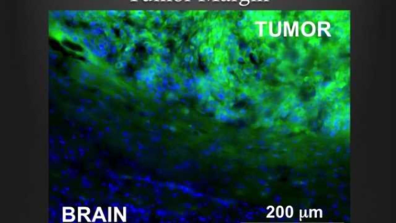 Ready, aim, fire! Cancer-targeting mechanism under development