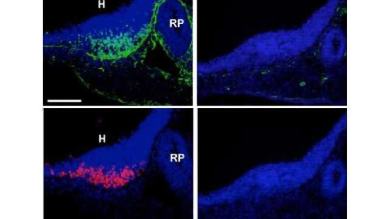 The brain-belly connection: Key genetic triggers found in weight-regulating brain cells