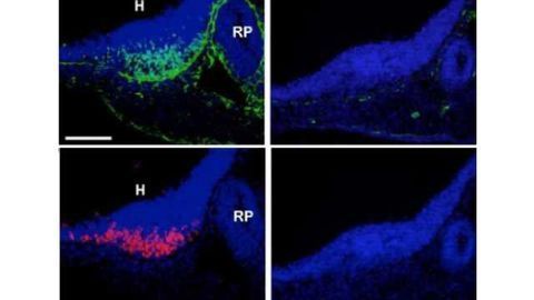 The brain-belly connection: Key genetic triggers found in weight-regulating brain cells