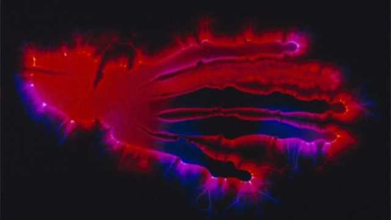 Depression often co-occurs with joint diseases