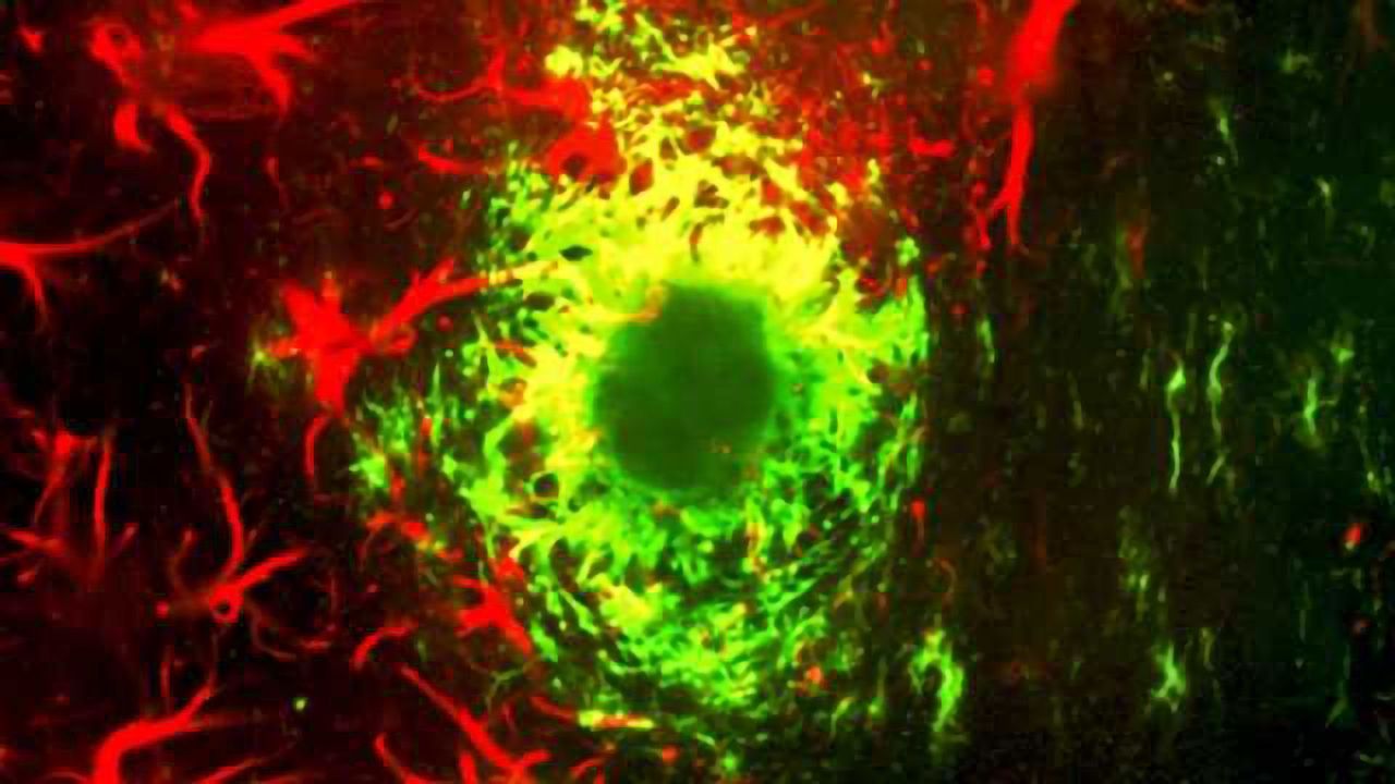 Experimental cancer drug restores memory in mouse model of Alzheimer’s