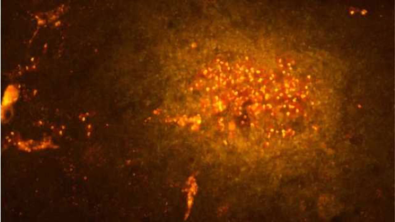 Migrating immune cells promote nerve cell demise in the brain