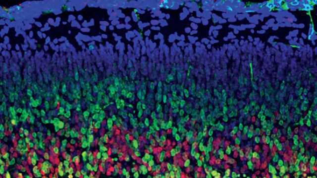 Mighty microexons take center stage in shaping of the brain
