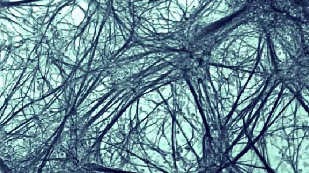 Study of brain networks shows differences in children with OCD