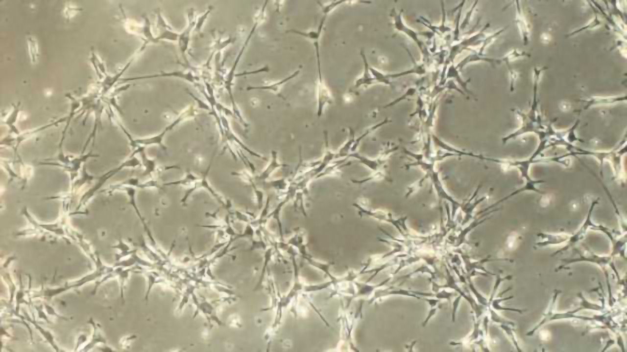 Possible progress against Parkinson's and good news for stem cell therapies