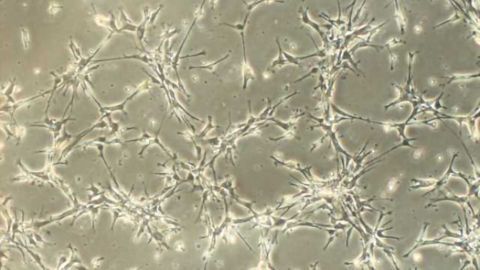 Possible progress against Parkinson's and good news for stem cell therapies