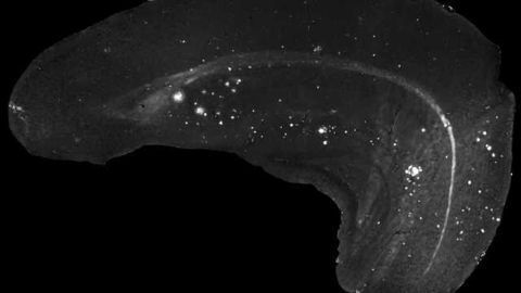 No evidence that low-frequency magnetic fields accelerate development of Alzheimer's disease or ALS