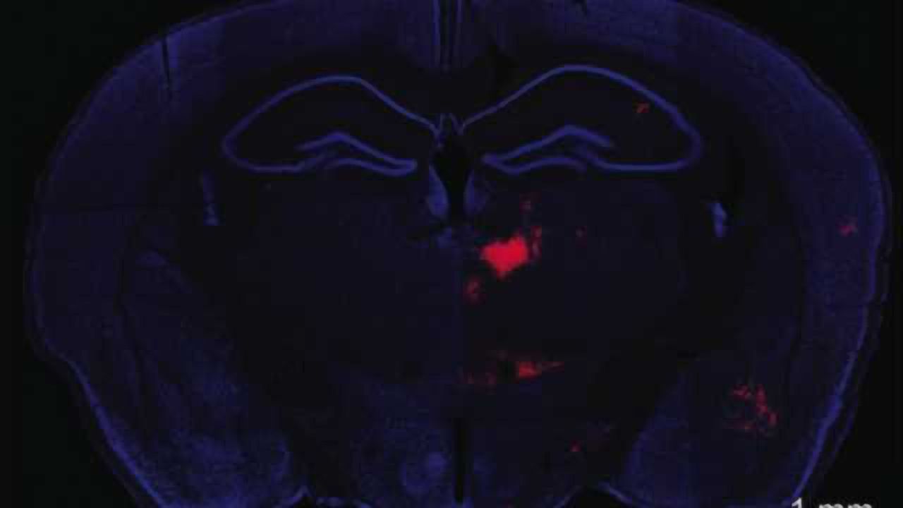 Important communication mechanism discovered between two brain areas implicated in schizophrenia