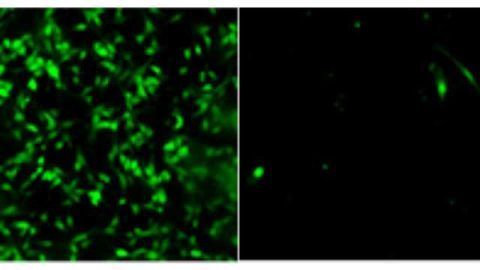 Investigators discover mechanism responsible for tumor invasion in brain cancer