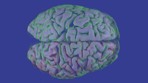Multiple sclerosis researchers study processing speed impact on cognitive training
