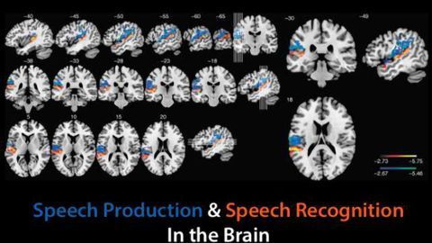 Mapping language in the brain