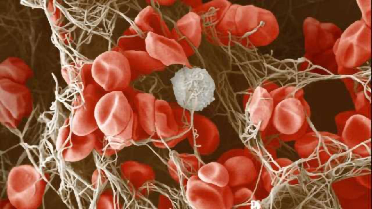 Effectiveness of new stroke treatment confirmed