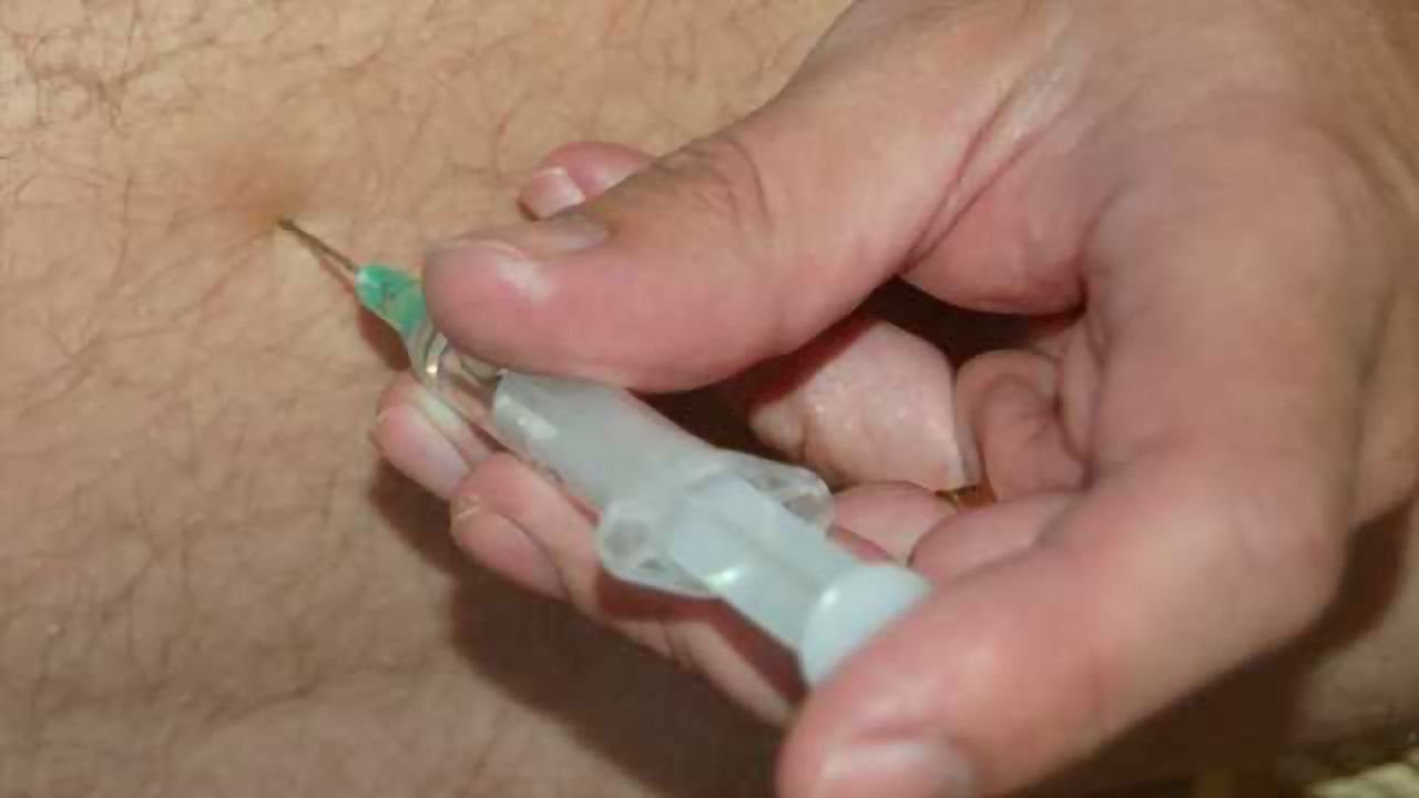 What happens when multiple sclerosis patients stop taking their medication?