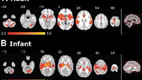 Babies feel pain 'like adults' concludes world's first MRI study on infant pain