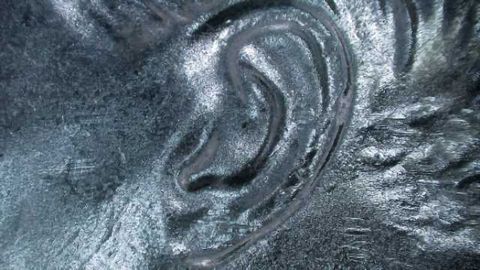 In search of tinnitus, that phantom ringing in the ears