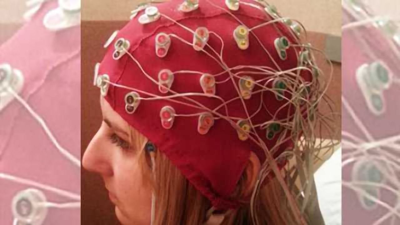 ‘Chemo brain’ is real, say researchers