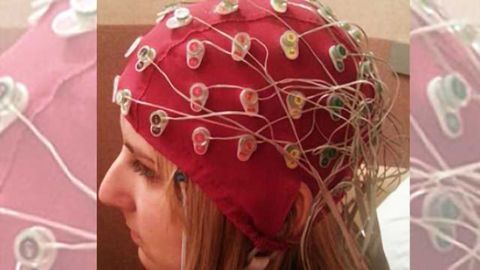 ‘Chemo brain’ is real, say researchers