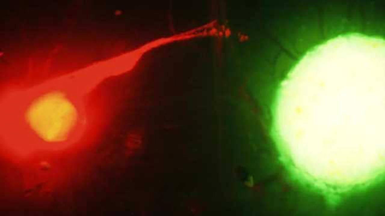 Deadly dance observed between nerves and cancer cells