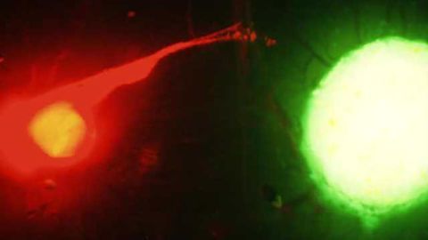 Deadly dance observed between nerves and cancer cells