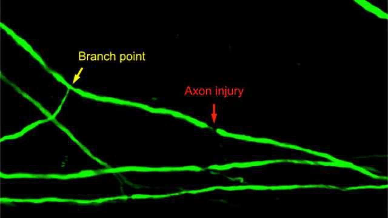 Spinal cord axon injury location determines neuron's regenerative fate