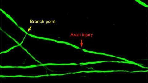 Spinal cord axon injury location determines neuron's regenerative fate