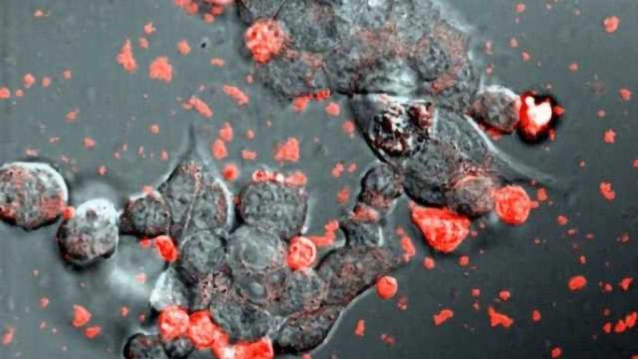 Cellular bubbles used to deliver Parkinson's meds directly to brain
