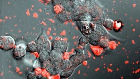 Cellular bubbles used to deliver Parkinson's meds directly to brain