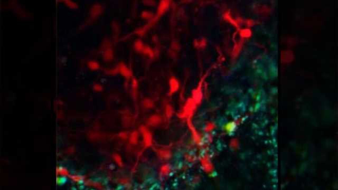 How do neural cells respond to ischemia?