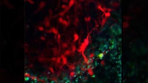 How do neural cells respond to ischemia?