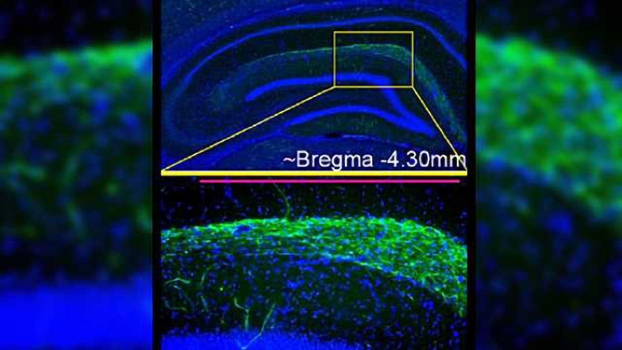 Researchers identify potential cause of schizophrenic symptoms