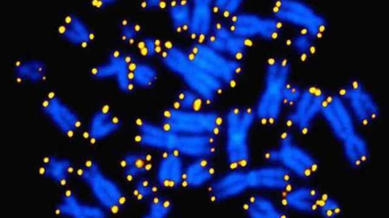 PTSD linked to accelerated aging