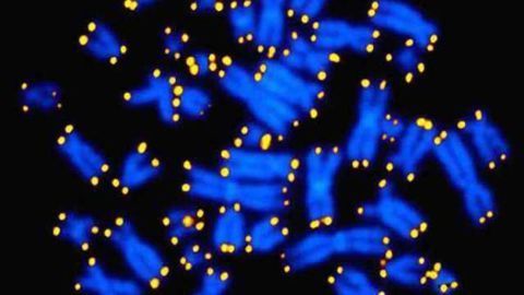 PTSD linked to accelerated aging