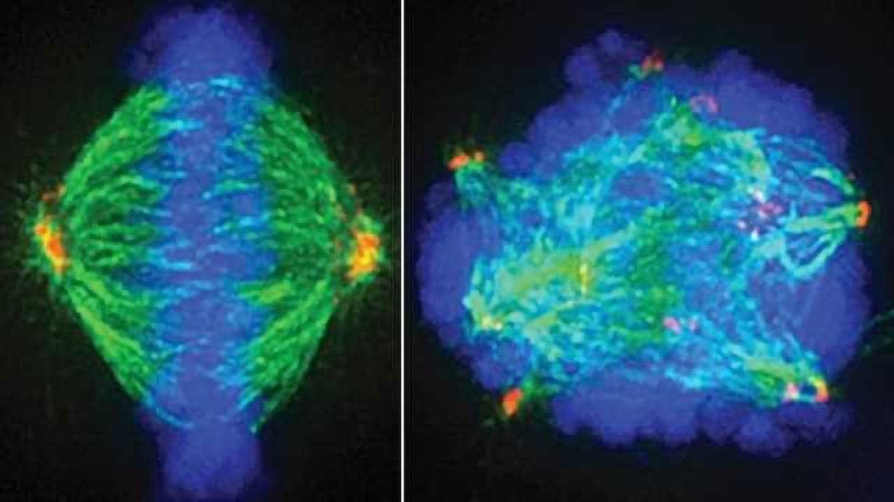 New combination treatment strategy to 'checkmate' glioblastoma