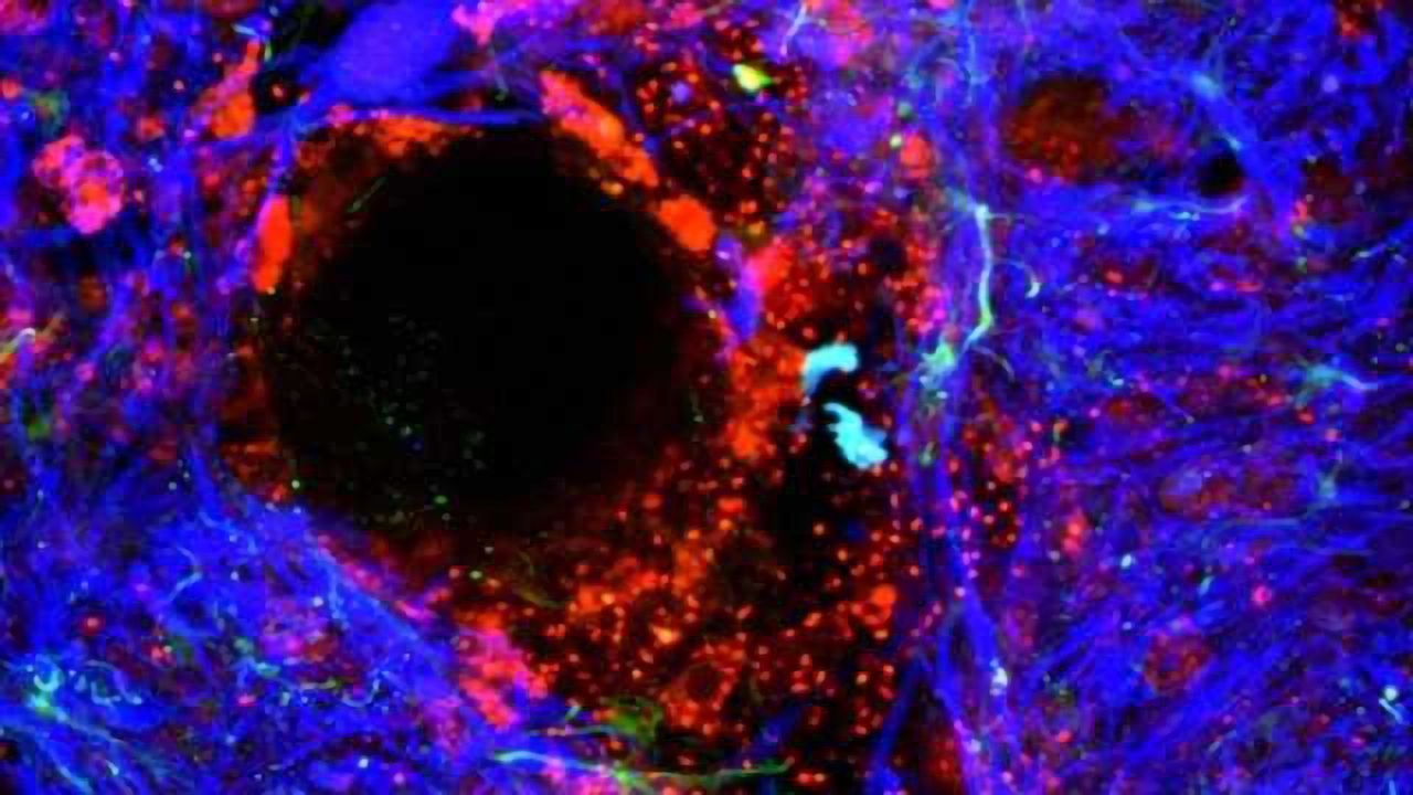 Breaking through the blood-brain barrier