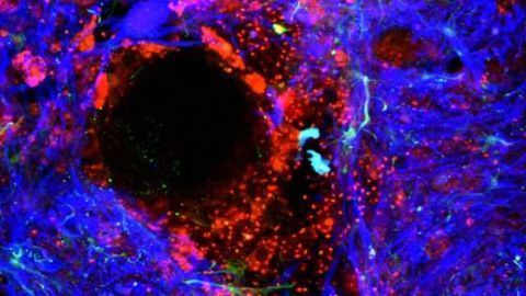 Breaking through the blood-brain barrier