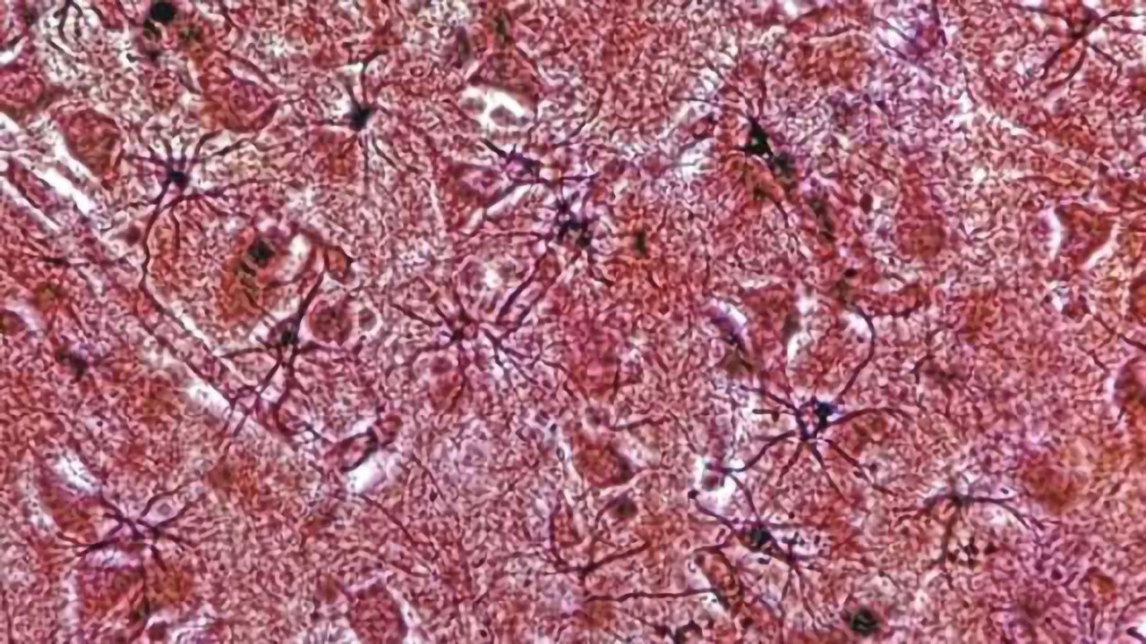 Every bite you take, every move you make, astrocytes will be watching you