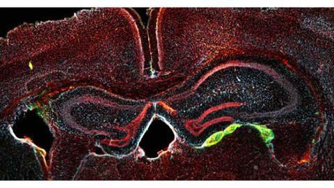 Blood to feeling: Scientists turn adult human blood cells into neurons