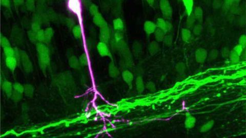 Chameleon proteins make individual cells visible