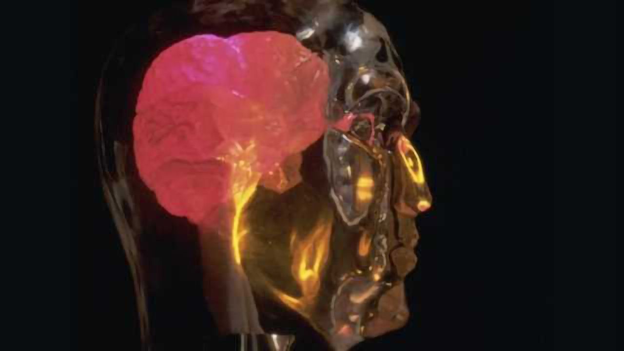 Surgical approaches mapped for auditory brainstem implantation