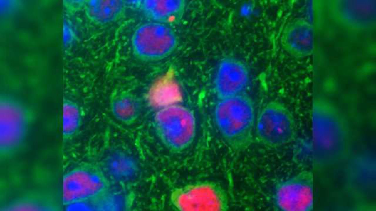 Scientists create mice with a major genetic cause of ALS and frontotemporal dementia