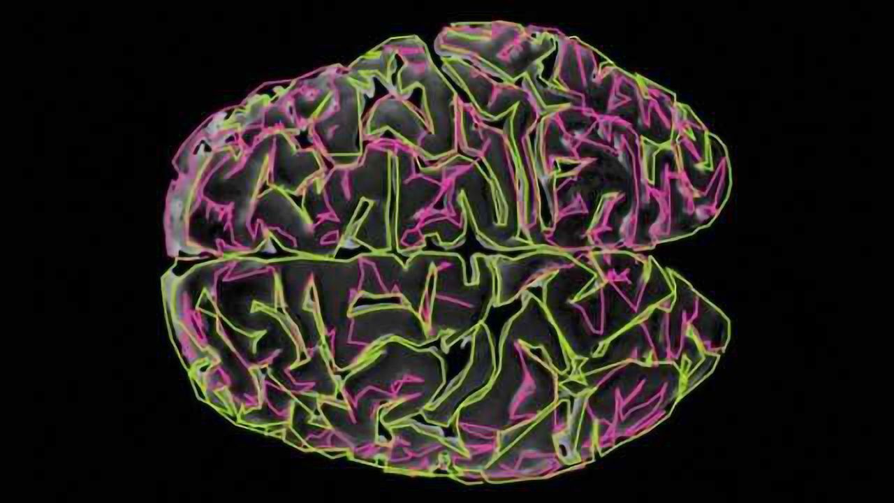 Study reveals autism's 'noisy' secret