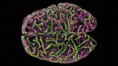 Study reveals autism's 'noisy' secret
